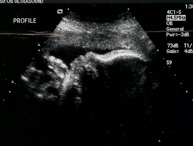 01-sonogram-feb-2009